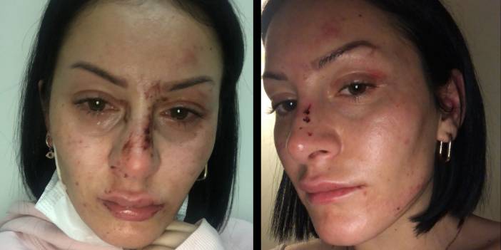 İstanbul Emniyeti'nden kadını döven polislerle ilgili açıklama