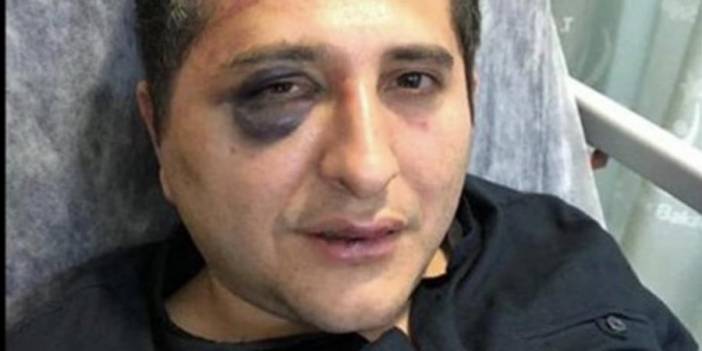 TBB, 'Avukata darp' soruşturması için harekete geçti: 'Cumhurbaşkanlığı korumaları hakkında kamu davası talebi'