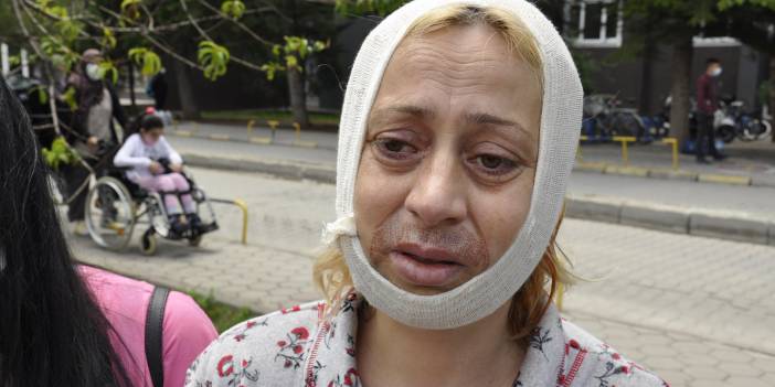 Sokak hayvanlarını beslerken darp edilen kadın yaşadıklarını anlattı