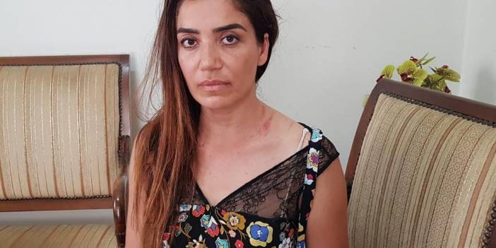 Muayenehaneyi paylaşamayan iki doktor birbirini darbetti