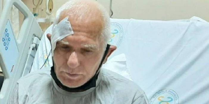 Tozkoparan'da elektriği kesilen mahalle sakini karanlıkta düşerek beyin kanaması geçirdi