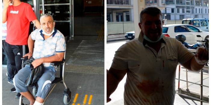 Kurban Bayramı'nın değişmezi: Acemi kasaplar kendilerini yaraladı