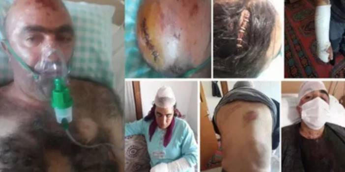 Dedeoğlulları ailesinin akrabası: Saldırıdan önce konuştum, tehdit edildiklerini söylediler