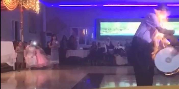 Alevli şov yapan davulcu yandı