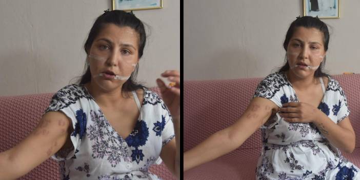 104 yerinden bıçakladığı çocuğunun annesi can çekişirken başında sigara içmiş