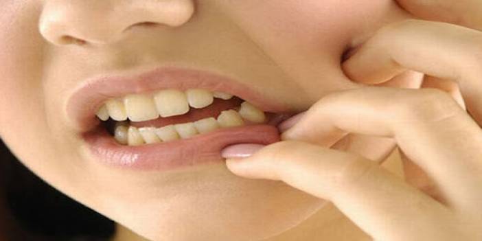1 hafta süren ağız ağrıları neye işaret ediyor?