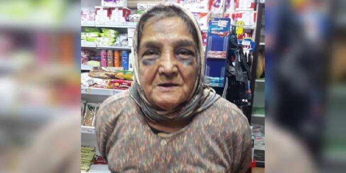 Eşinin darbettiği 73 yaşındaki kadın konukevine yerleştirildi