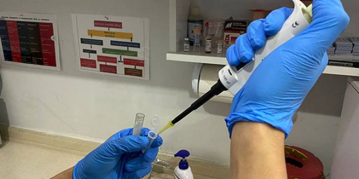 Çiğ et, süt, su ve topraktan ‘kör eden parazit’ aktarımı kedilerden daha fazla