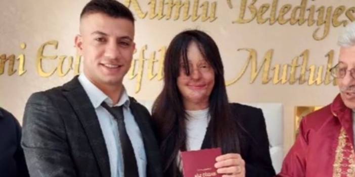 Berfin, yüzüne asit atan Ozan Çeltik'le evlendi