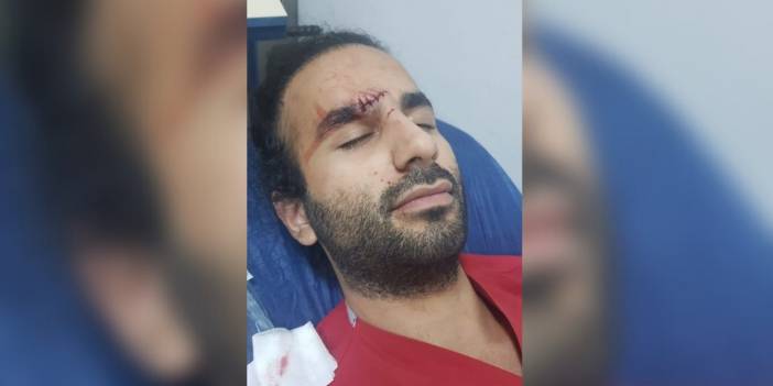 Alkollü geldiği hastanede doktora kafa attı