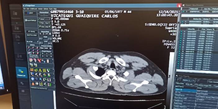 İstanbul Havalimanı'nda uyuşturucu kuryesi bayılınca yakalandı