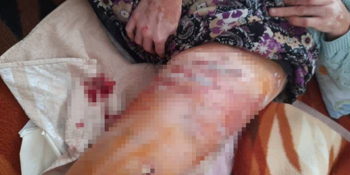 Bir Pitbull vakası daha! Talihsiz kadın kendini arabaya kitleyerek kurtuldu