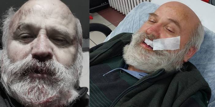 Hürriyetçi Eğitim-Sen'in bir yöneticisi daha saldırıya uğradı