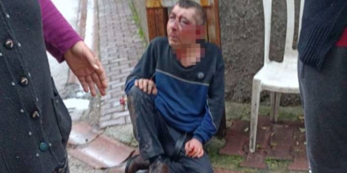Fırın çalışanını öldüresiye dövüp evinin önüne bıraktılar