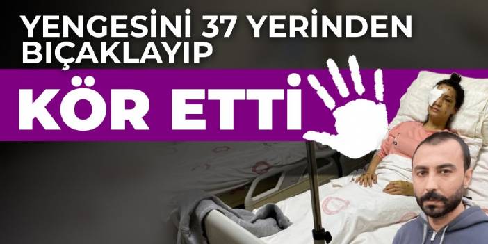 Yengesini 37 yerinden bıçaklayıp kör etti