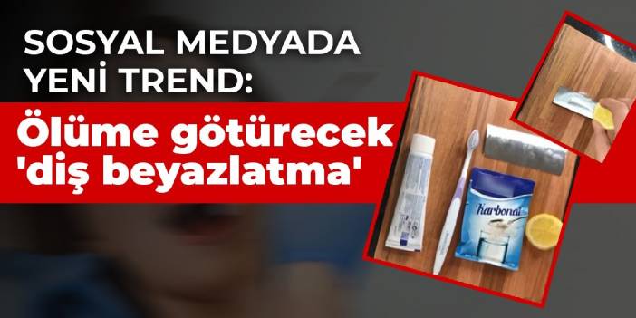 Sosyal medyada yeni trend: Ölüme götürecek 'diş beyazlatma' akımı