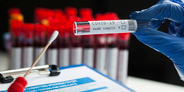 PCR testini özel hastanede yaptıranlar dikkat! Ücret iade edilmezse 5 katı ceza