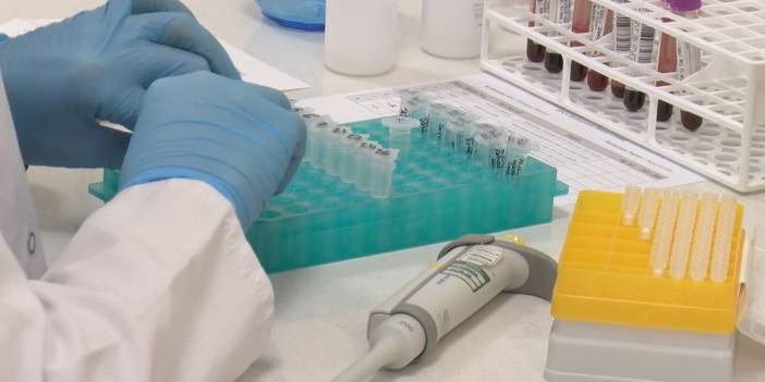 Düğün sezonu öncesi 'SMA taraması' uyarısı