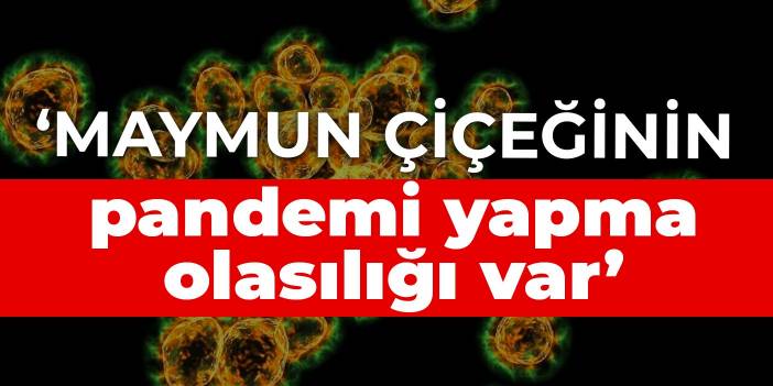 Prof. Azap: Maymun çiçeğinin pandemi yapma olasılığı var