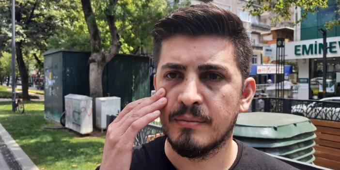 Hemşirenin burnunu kırdı, adli kontrolle serbest kaldı