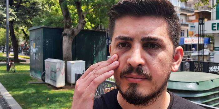 Hemşirenin burnunu kıran hasta yakını yeniden gözaltında