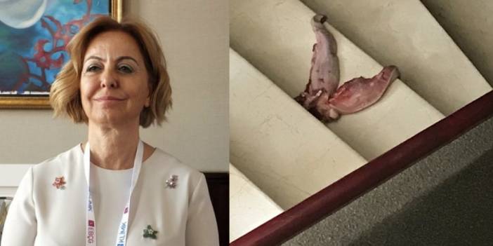 Prof. Dr. Esin Şenol'u tehdit eden şüpheli serbest bırakıldı