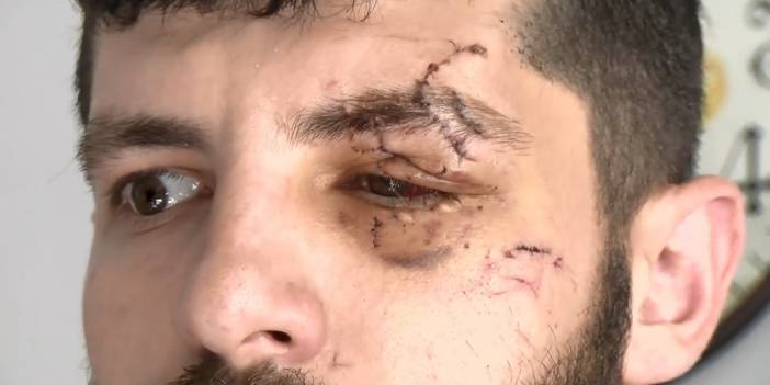 Maaşını istedi, muhasebeci bu hale getirdi