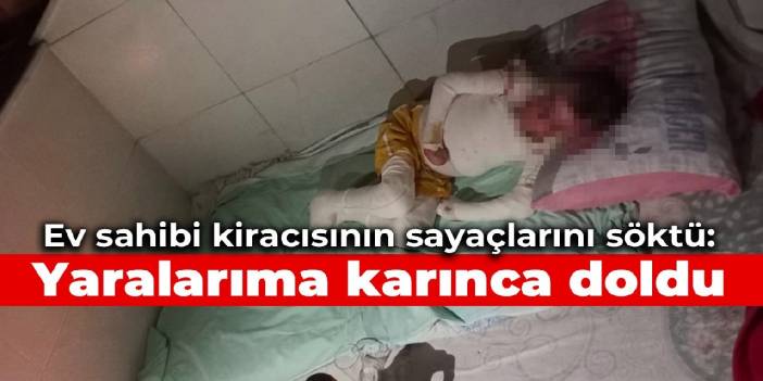 Ev sahibi kiracısının sayaçlarını söktü: Yaralarıma karınca doldu