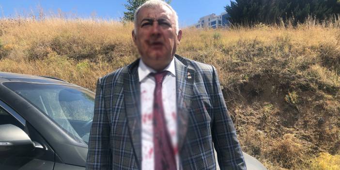 Zafer Partisi Kurucusu istifasını duyurdu: Ümit Özdağ azmettirdi, 20 kişi ile darp ettiler