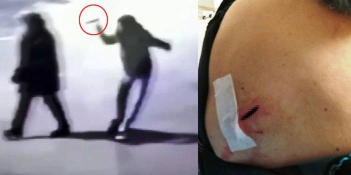 Sırtından bıçaklanan kadın konuştu