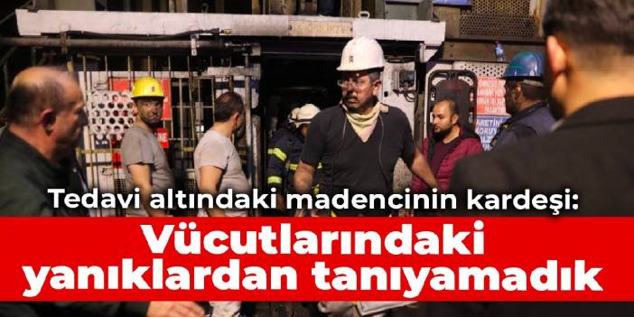 Tedavi altındaki madencinin kardeşi: Vücutlarındaki yanıklardan tanıyamadık