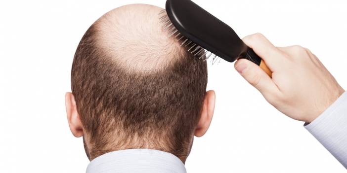 Kellik tarihe mi karışıyor? Japon bilim insanları buldu!