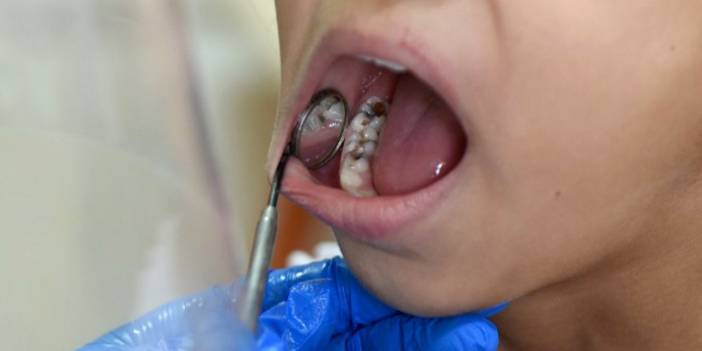 It leads to death in 24 hours: The risk of 'mediastinitis' in dental inflammation