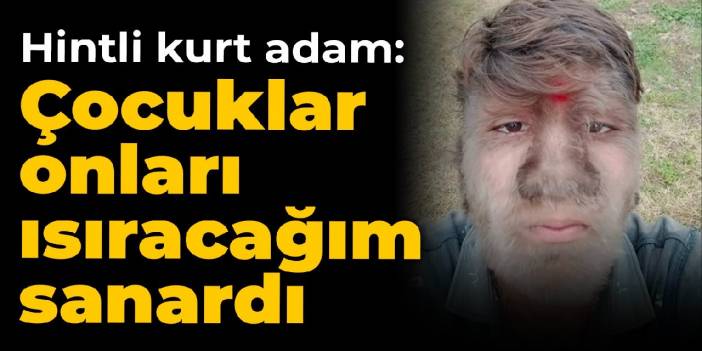 Hintli kurt adam: Çocuklar onları ısıracağım sanardı
