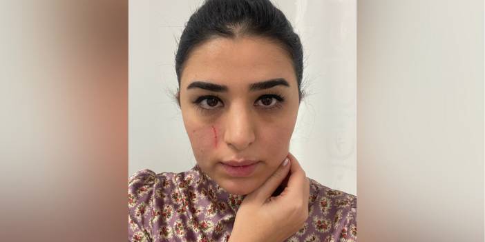 Doktoru darbeden 2 kişiye gözaltı