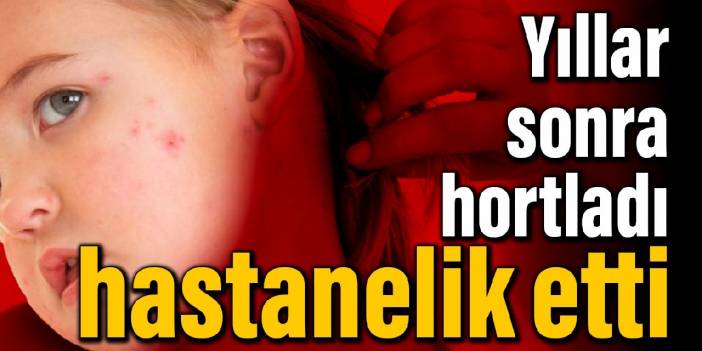 Yıllar sonra hortladı, hastanelik etti