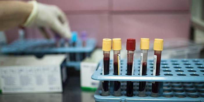 Dikkat çeken kanser uyarısı! Kanser vakaları pandemi döneminde neden arttı?