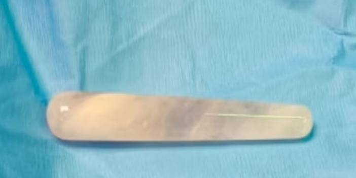 Seks oyuncağını yanlış yere sokan kadın hastanelik oldu! Ameliyatla çıkardılar...