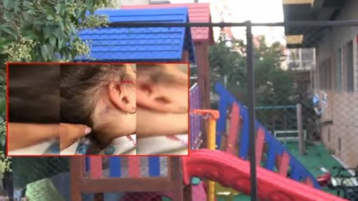 2.5 yaşındaki çocuk, yaşıtları tarafından şiddete uğradı
