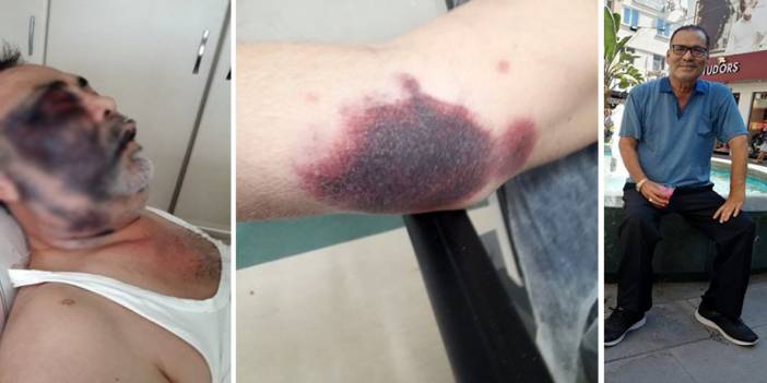 Savcılıktan, darp edilerek öldürülen Mümin Kara hakkında açıklama