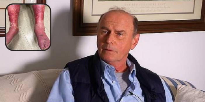 ABD'de Johnson&amp;Johnson aşısı 'yan etki' skandalı