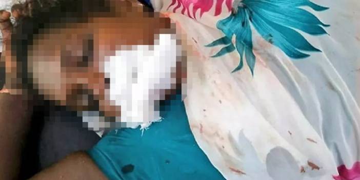 Hindistan'da bir kadın, desteklediği parti seçimleri kazanınca dilini kesti